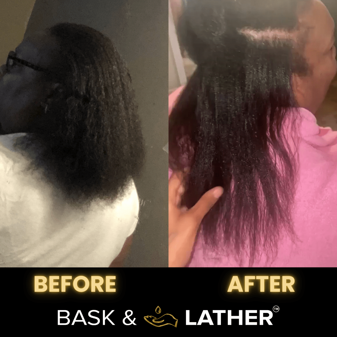 Scalp Stimulator | Hair Growth Oil