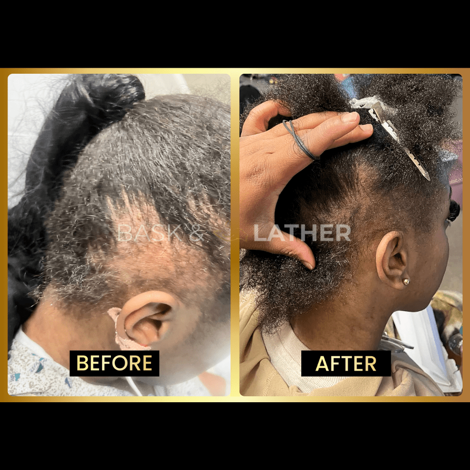 Growth & Length Retention Bundle
