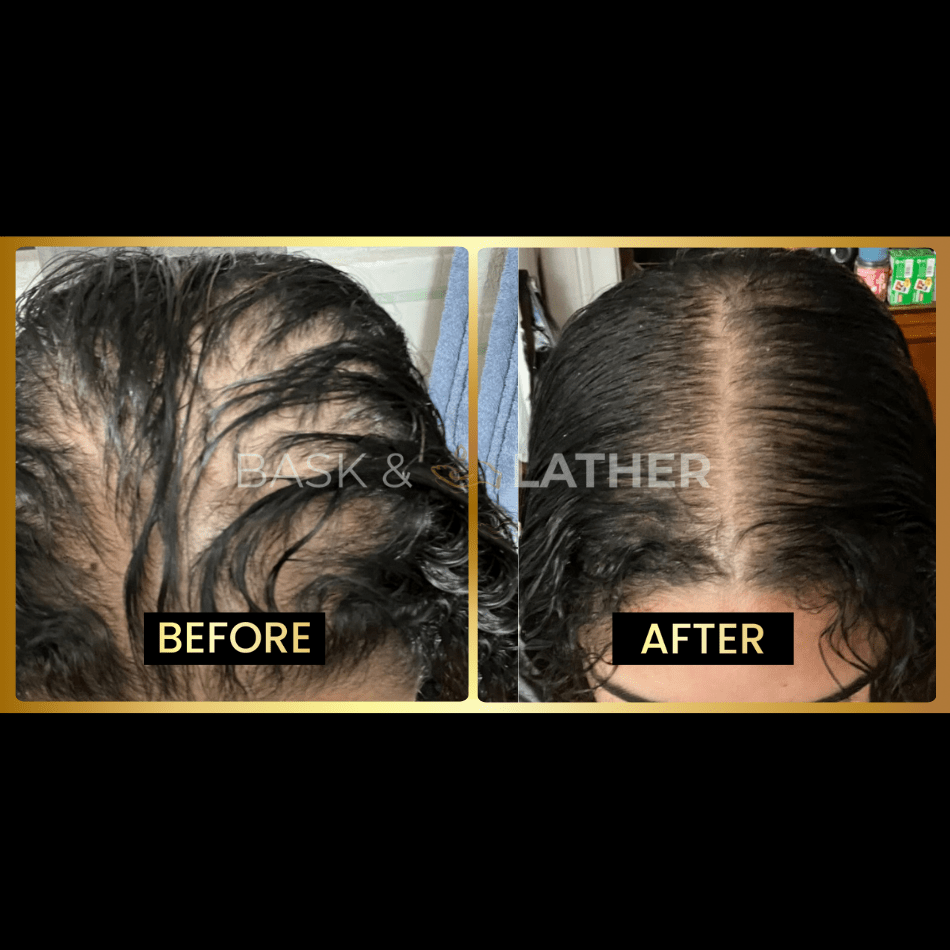 JUMBO Scalp Stimulator