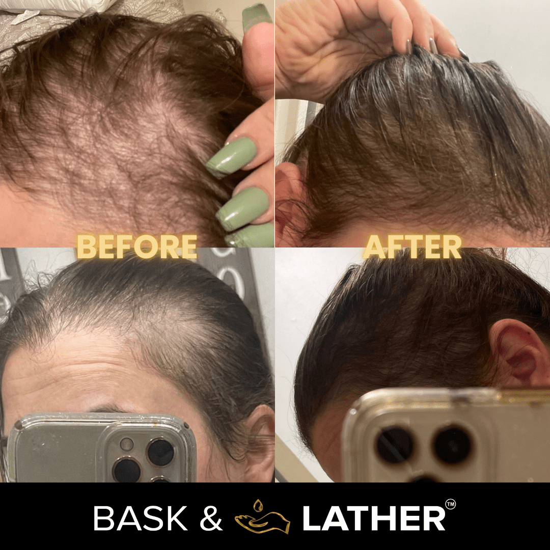 Scalp Stimulator | Hair Growth Oil