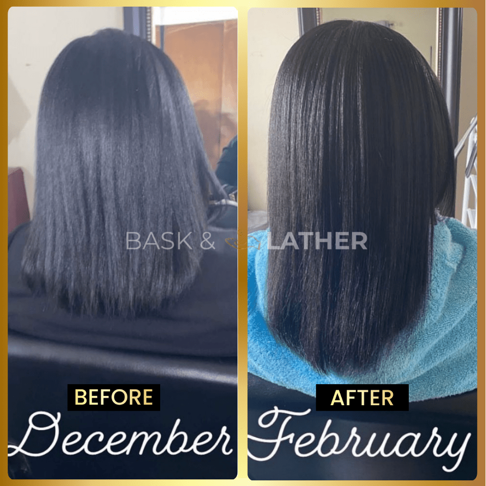 JUMBO Scalp Stimulator