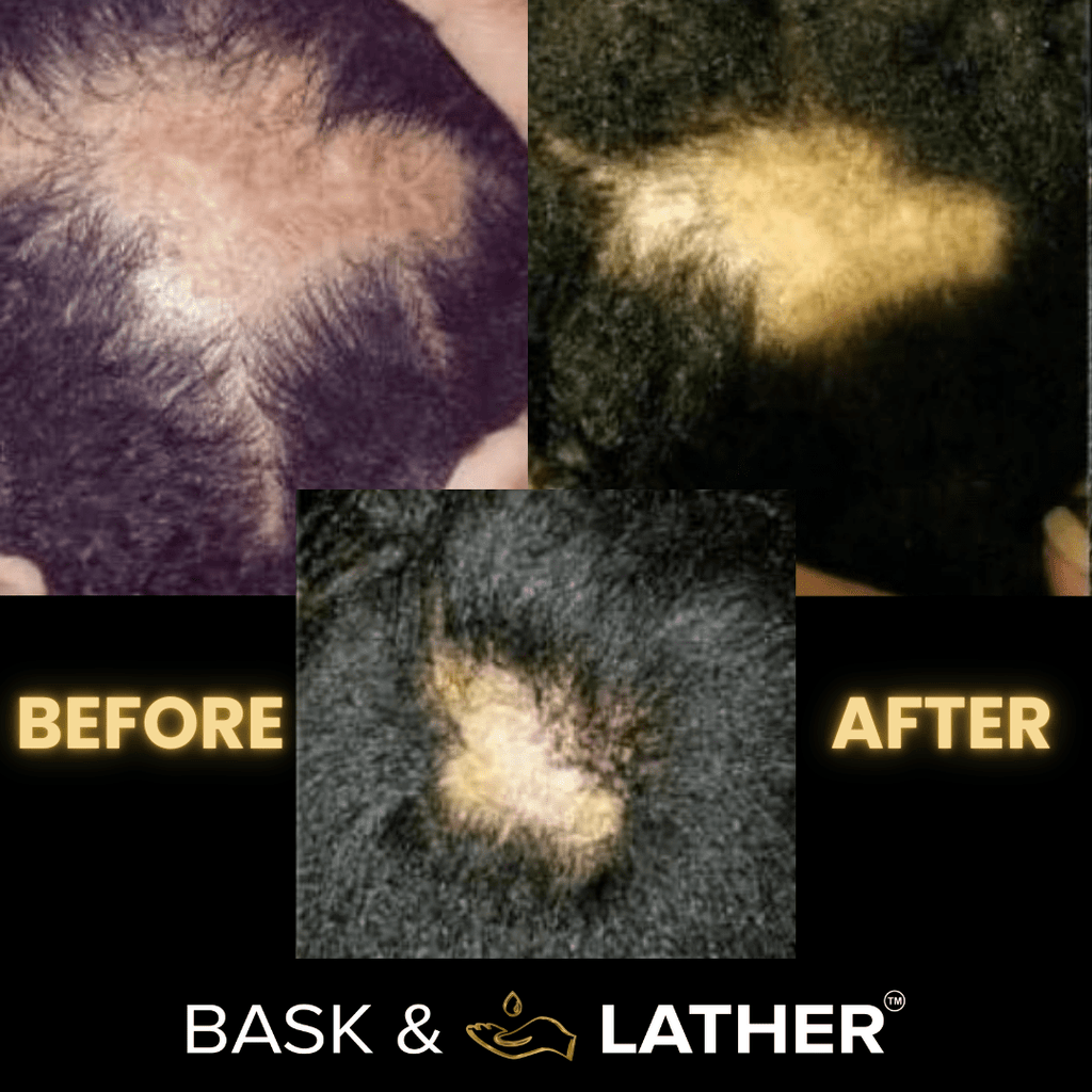 Scalp Stimulator | Hair Growth Oil