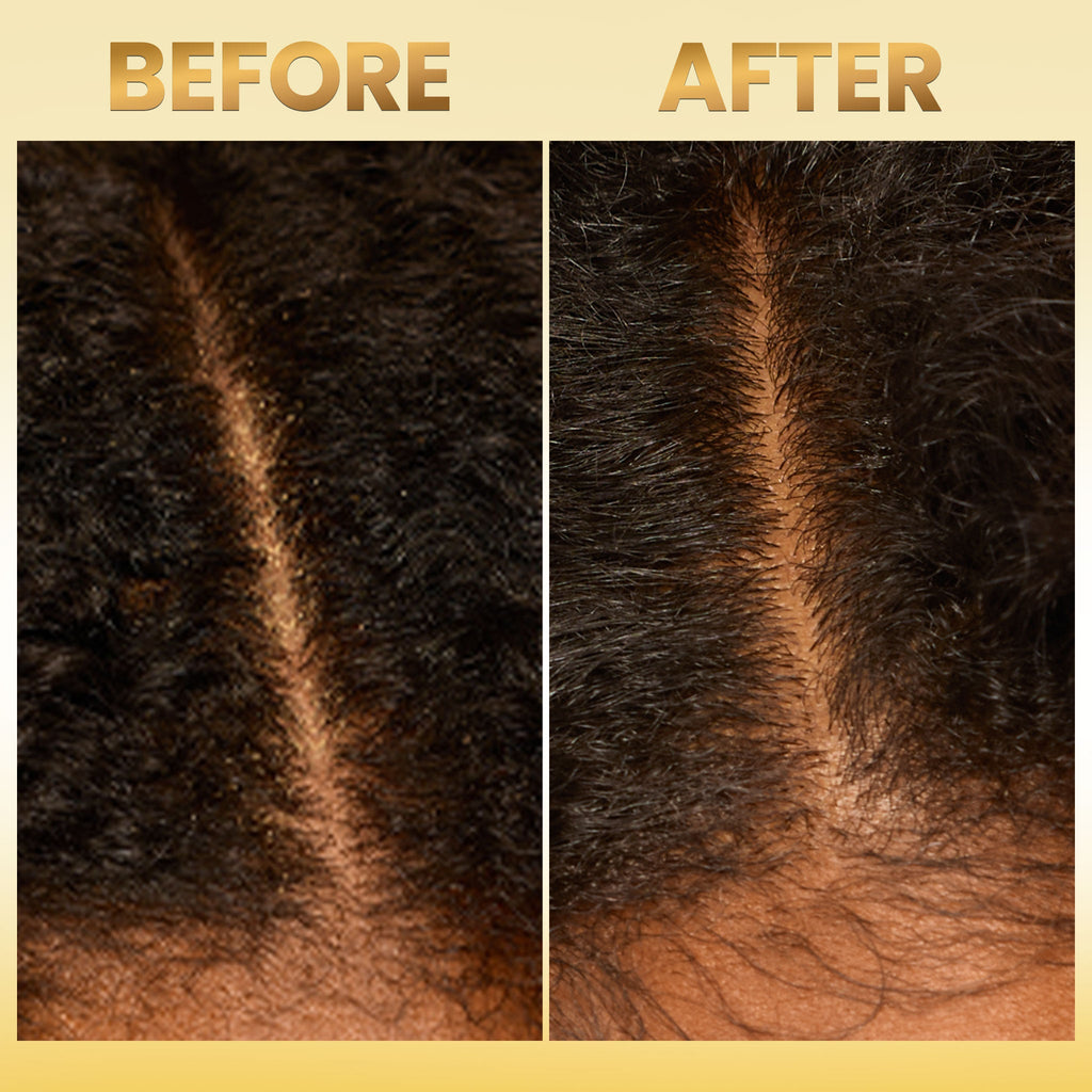 Scalp Balancing Shampoo & Scalp Restoring Conditioner Set